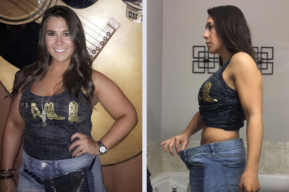 JSAPA Success Story - Dana before and after surgery