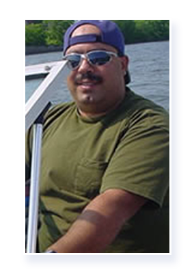 JSAPA Success Story - Steve before surgery